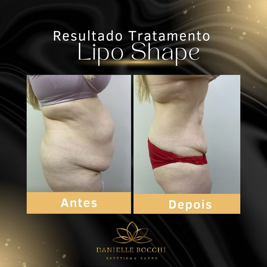Card de antes e depois publicado pela clínica