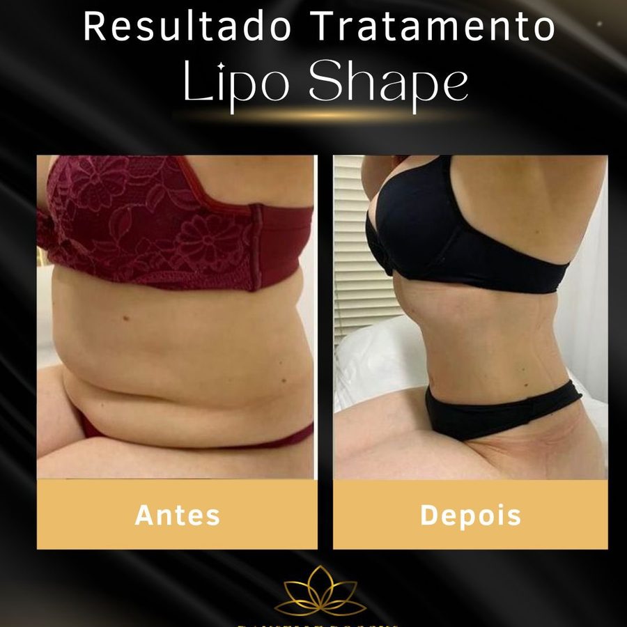 Card de antes e depois publicado pela clínica