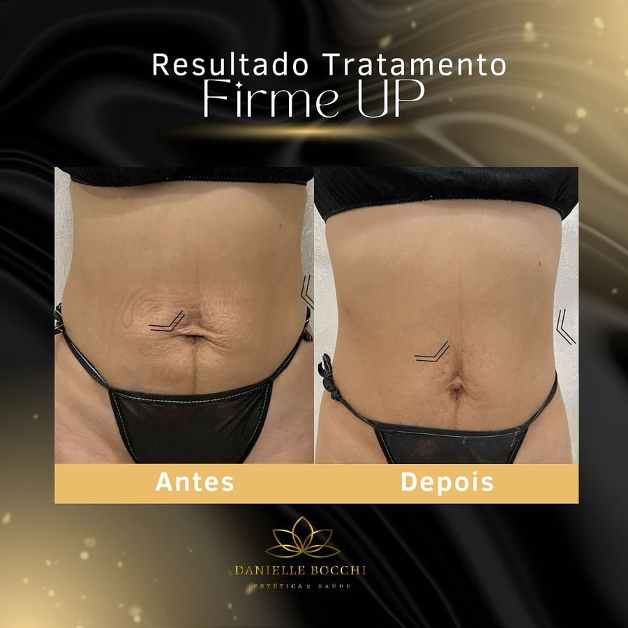 Card de antes e depois publicado pela clínica