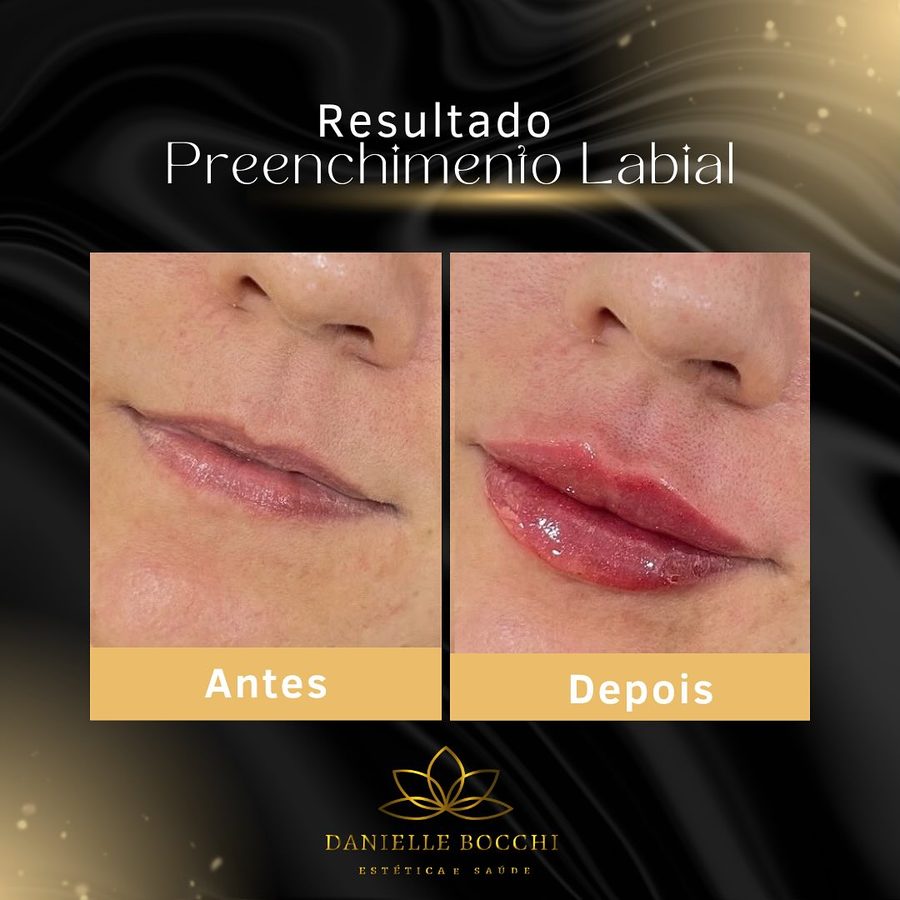 Card de antes e depois publicado pela clínica