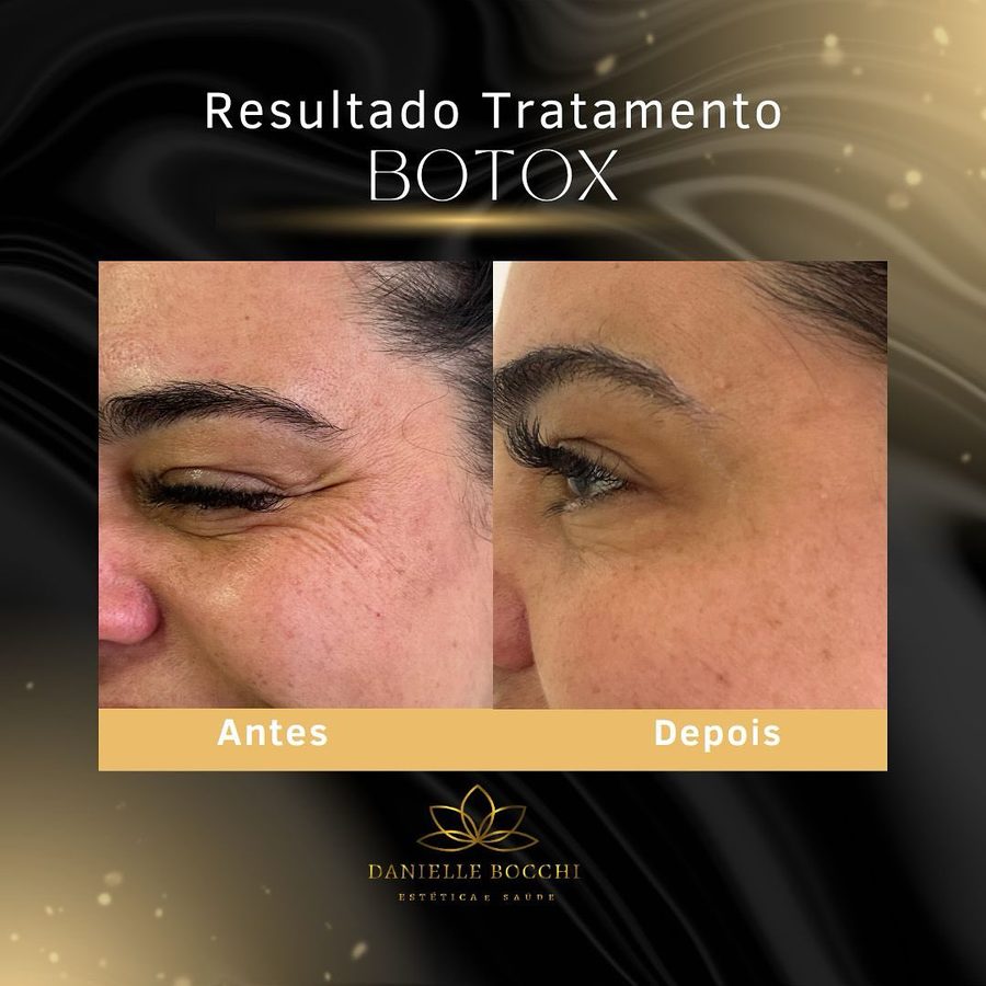 Card de antes e depois publicado pela clínica