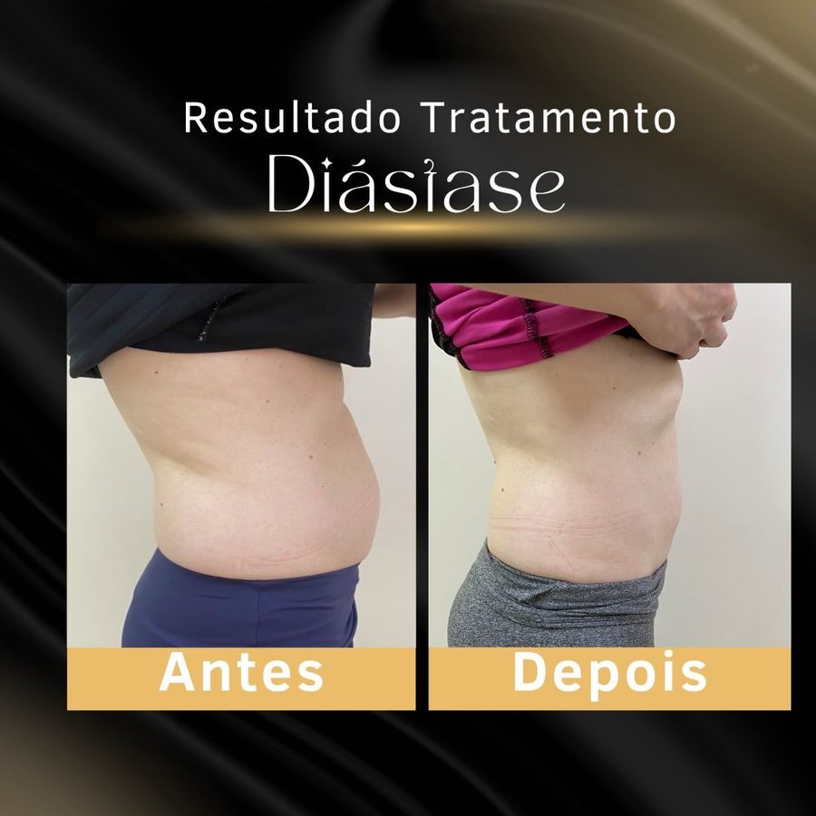 Card de antes e depois publicado pela clínica